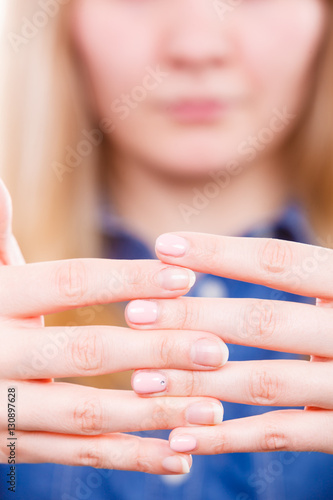 Woman presents hands nails.