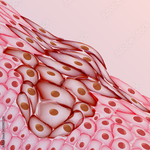 Growing Tumor, Tissue Section - Vector Illustration