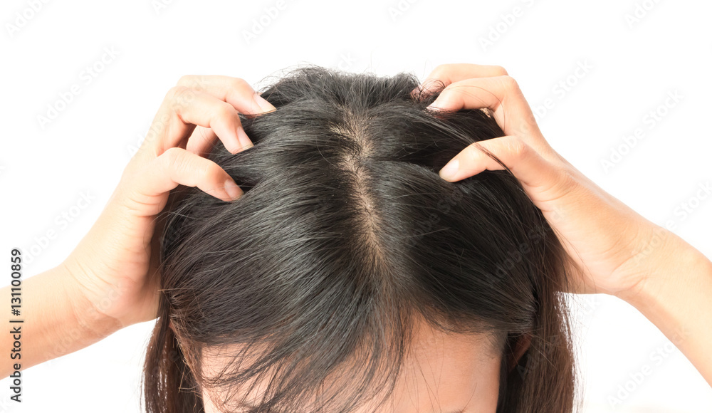 Closeup woman hand itchy scalp, Hair care concept Closeup woman hand itchy scalp, Hair care concept