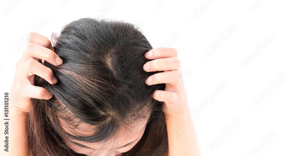 Fototapeta premium Closeup woman hand itchy scalp, Hair care concept