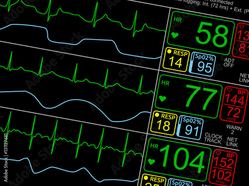 Patient's vital signs on ICU monitor, isolated closeup, dutched right