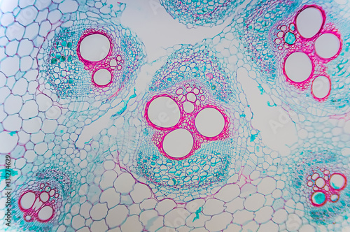 Cell microscopic- Cucurbits Stem photo