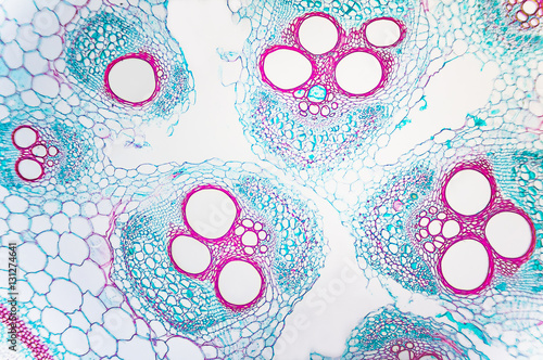 Cell microscopic- Cucurbits Stem photo