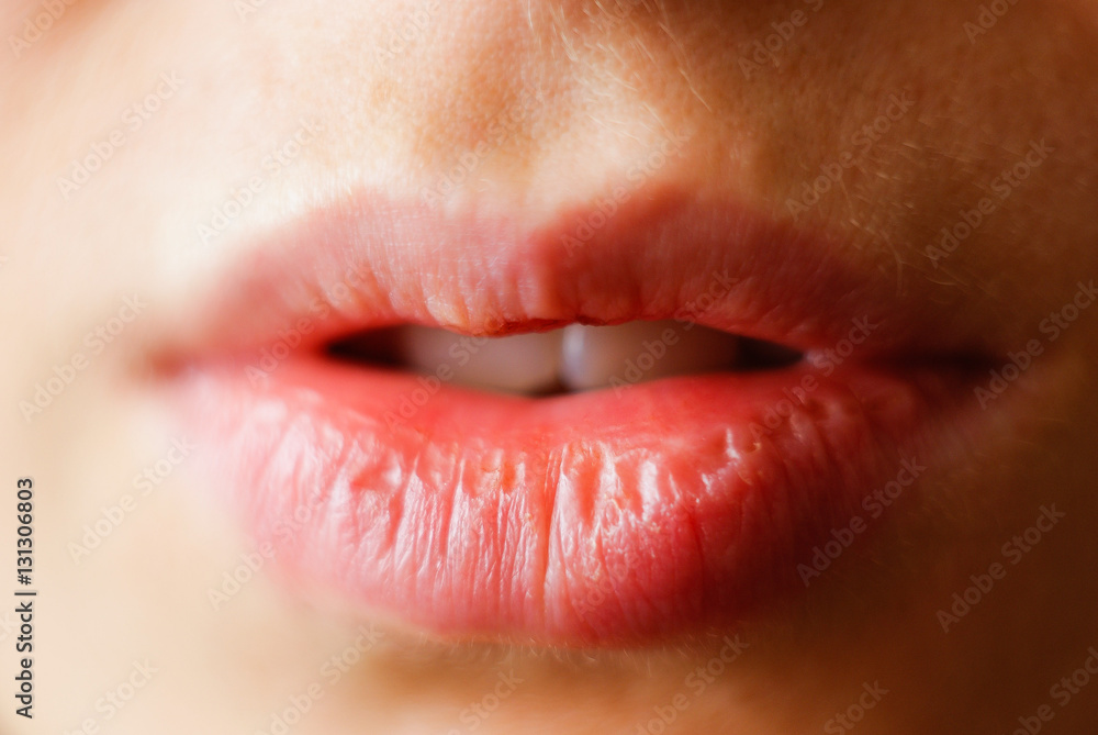 Natural lips. Close up shoot of young beautiful girl. Lips without make-up. Natural lips. Close up shoot of young beautiful girl. Lips without make-up.