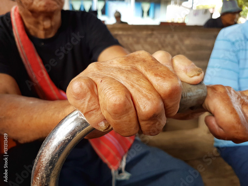 closeup hands of asian old man suffering from leprosy holding iron cane, Thailand. photo