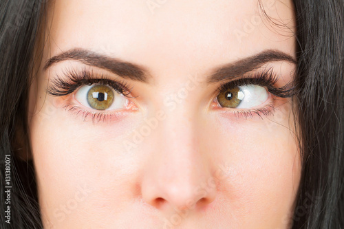 crazy female eyes with strabismus photo