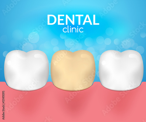 Dental desease clinic concept. Tooth healthcare hygiene. Toothache need dentist