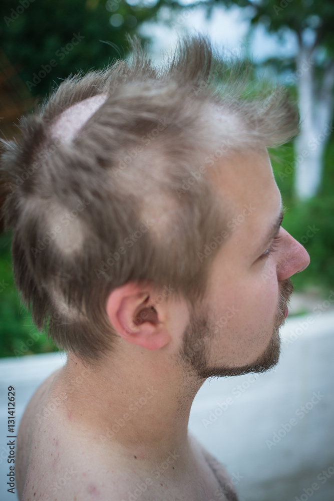 Young man closeup portrait with damaged hair Young man closeup portrait with damaged hair