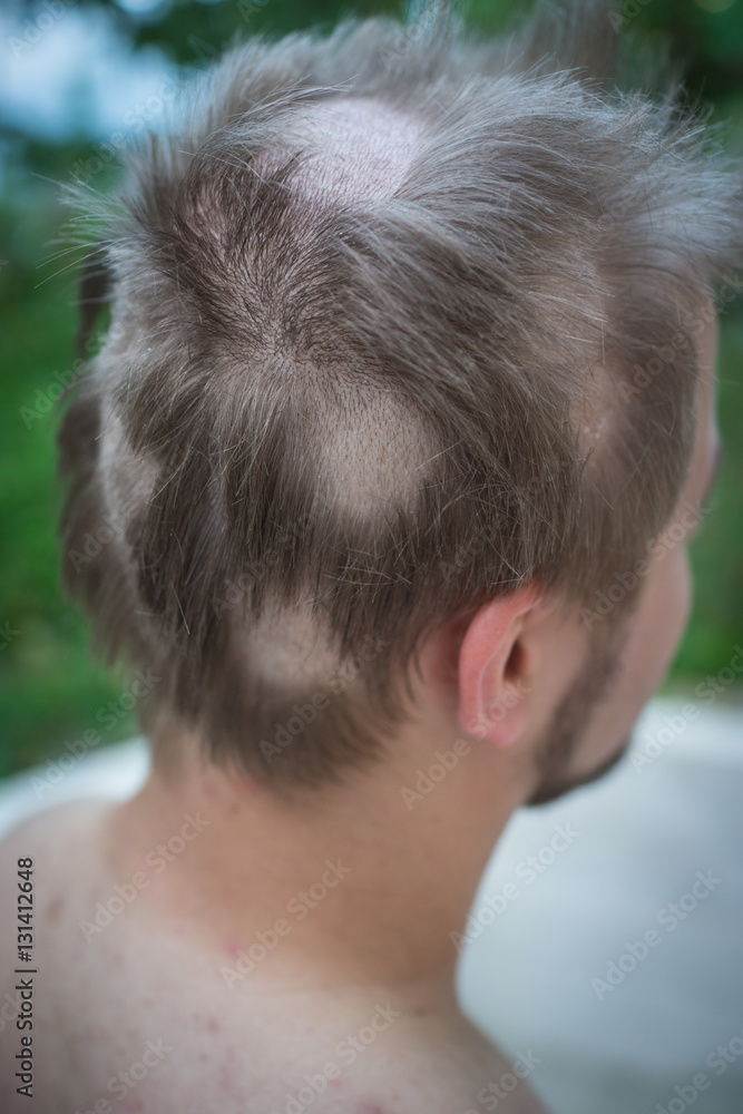 Obraz premium Young man closeup portrait with damaged hair