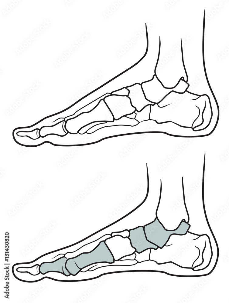 Flatfoot, The structure of the legs with flat feet and normally feet on