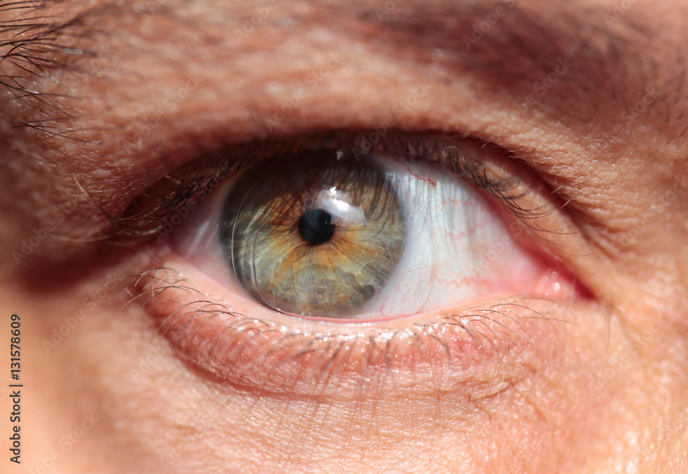 Fototapeta premium Ojo con lente de contacto descolocada