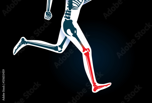 Human Leg bone and foot while run have a red signal. This illustration about pain symptom on leg from movement or running.