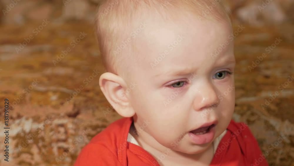 A beautiful baby with allergies. Red swollen eyes. The boy was crying and struggling with the disease. Kid 1 year. Close-up A beautiful baby with allergies. Red swollen eyes. The boy was crying and struggling with the disease. Kid 1 year. Close-up
