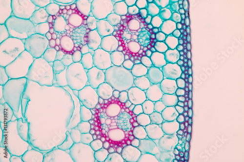 Tableau sur toile Stem typical Monocot and Dicot under a microscope.