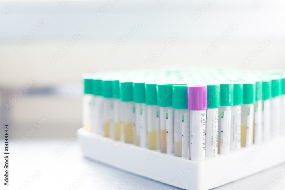 test tube on white background test tube on white background
