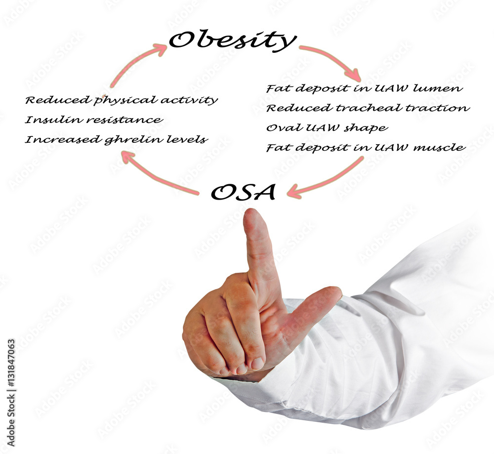 Relationship between OSA and obesity Relationship between OSA and obesity