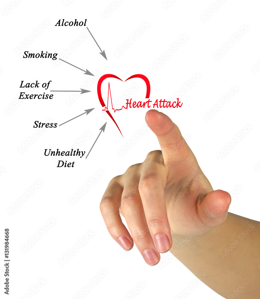 causes-of-heart-attack-stock-photo-adobe-stock