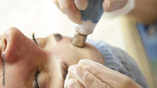 Diamond microdermabrasion, peeling treatment at cosmetic beauty spa clinic. woman getting a vacuum microdermabrasion procedure