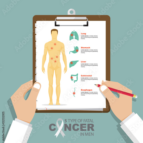 infographic for top 5 type of fatal cancer in men in flat design. Clipboard in doctor hand. Medical and health care report. Vector Illustration.