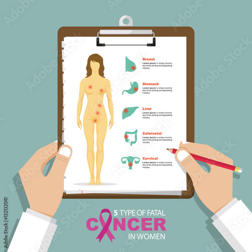 infographic for top 5 type of fatal cancer in women in flat design. Clipboard in doctor hand. Medical and health care report. Vector Illustration.