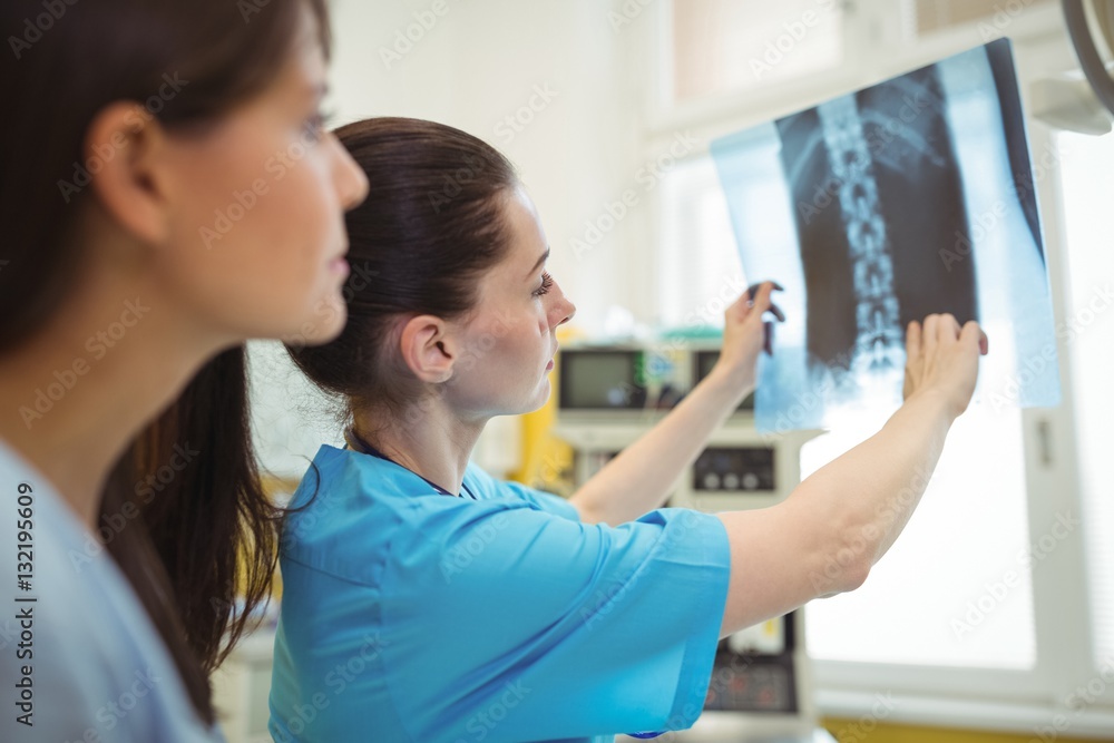 Female doctors examining x-ray