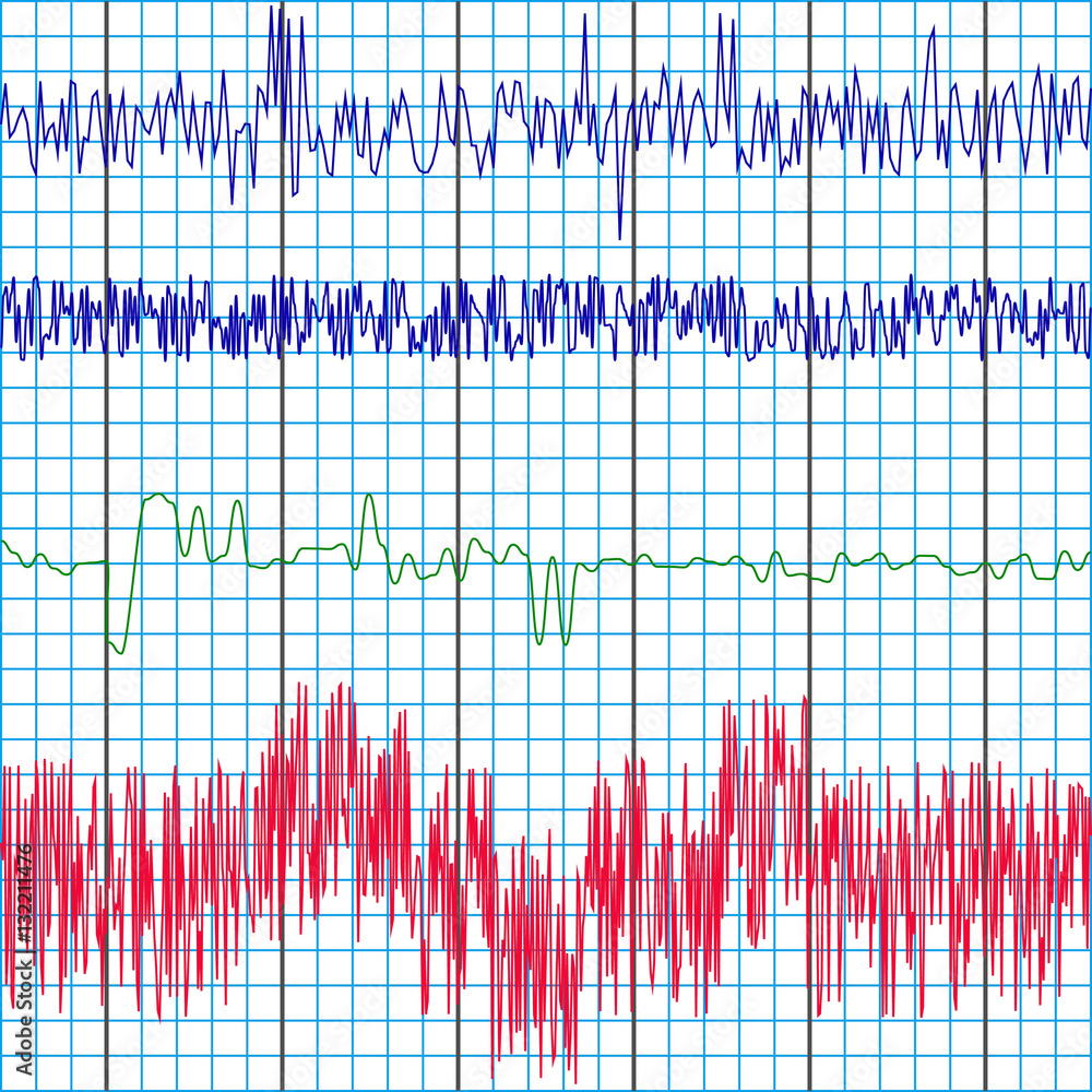 Vetor De Screen Recording Of The Polygraph Test Charts Of A Lie 