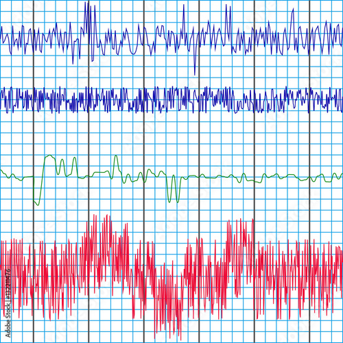 screen recording of the polygraph test charts of a lie detector to determine truth or lies , vector template photo