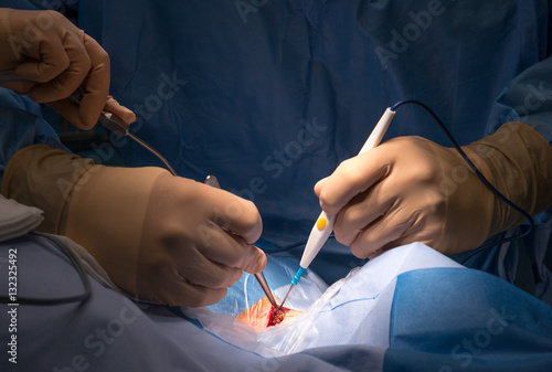 Particolari di intervento chirurgico in sala operatoria  photo
