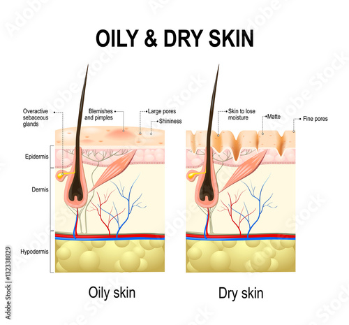 Oily and dry skin