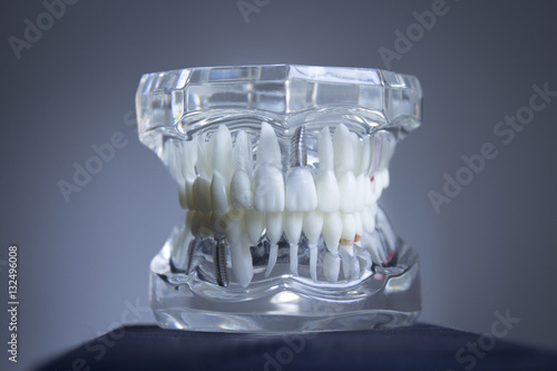 Denture for students transparent