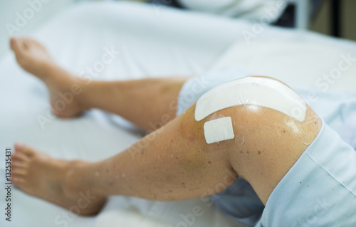 Close up- Knee replacement surgery after operation patient on the bed in hospital