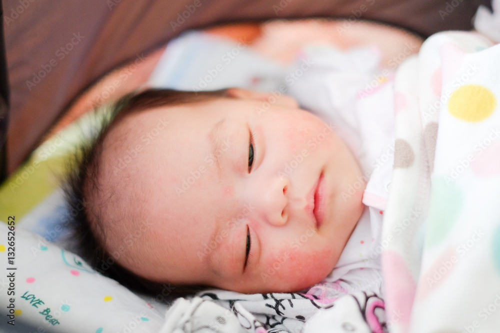 Portrait of a newborn baby close-up. face baby rashes Portrait of a newborn baby close-up. face baby rashes
