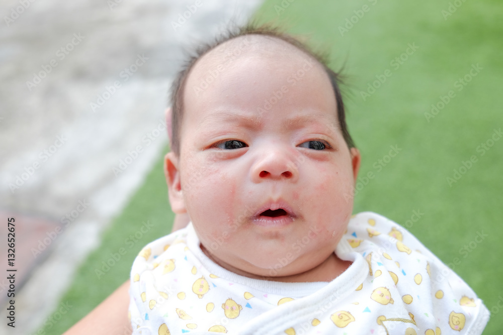 Portrait of a newborn baby close-up. face baby rashes Portrait of a newborn baby close-up. face baby rashes