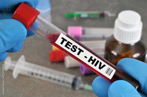Tube de sang pour un test HIV photo
