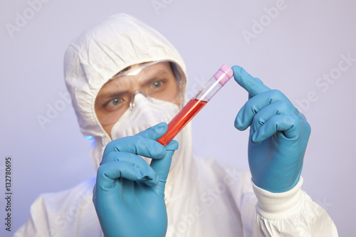 Scientist holds test tube with blood infected