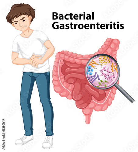 Man and diagram showing bacterial gastroenteritis