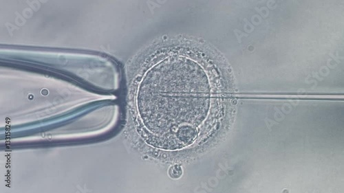 Viewing through microscope on icsi in vitro fertilization procedure, needle puncture of human egg and sperm injection.
