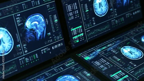 MRI Brain Scan Analysis Monitors