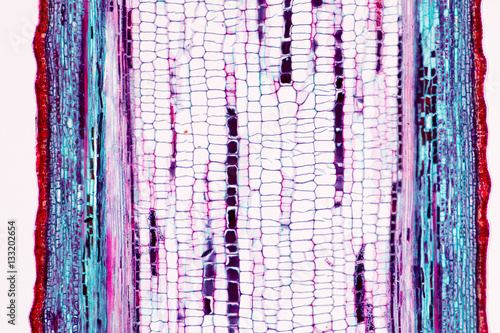 Φωτογραφία Background of Abscission layer cell under the microscope.
