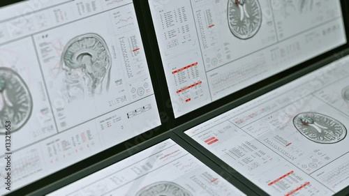 MRI Brain Scan Analysis Monitors