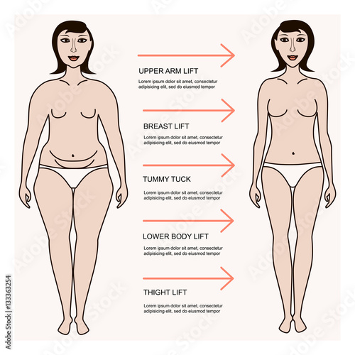 Body correction, lose weight, concept for banner or flyer, abstract isolated vector illustration