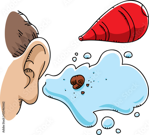 A cartoon of an ear war flush showing a huge gob of wax that was clogging the ear canal.