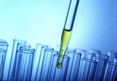 Closeup of a pipette dropping yellow sample into a test tube on light blue background