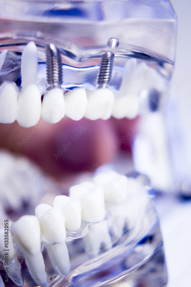 Dentists dental teeth model