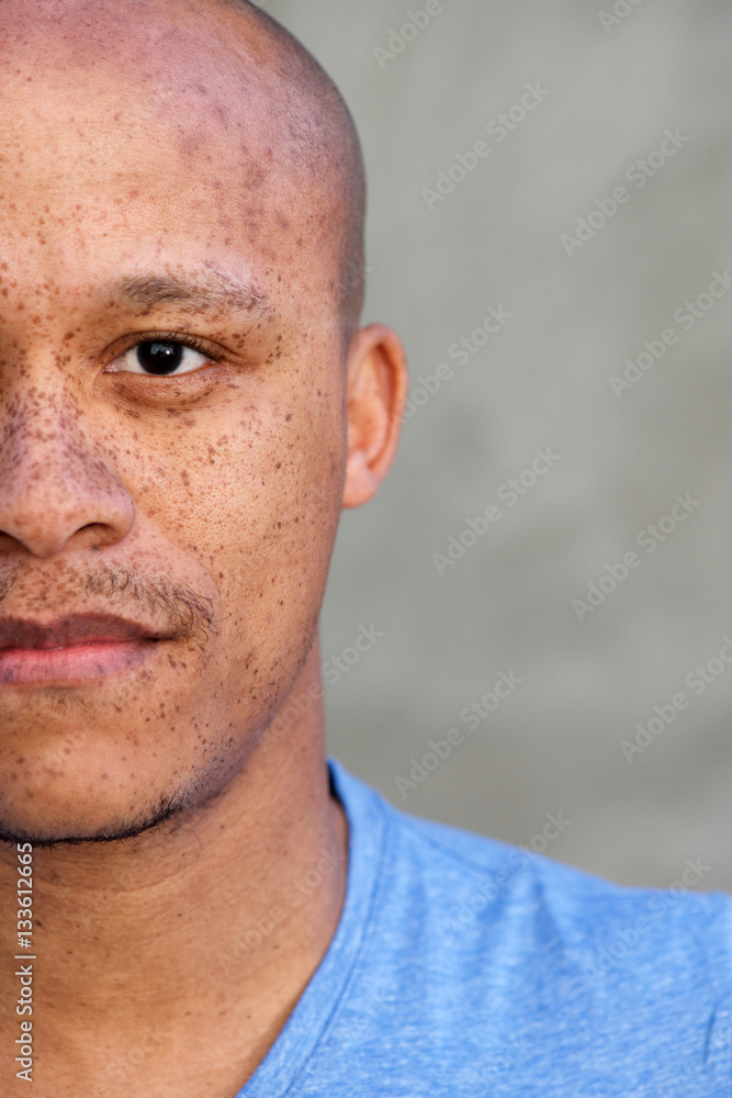 Naklejka premium half face african american man with freckles