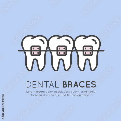Isolated Vector Style Illustration Logo Badge or Dental Tooth Braces Installation Process, Aesthetics, Orthodontist