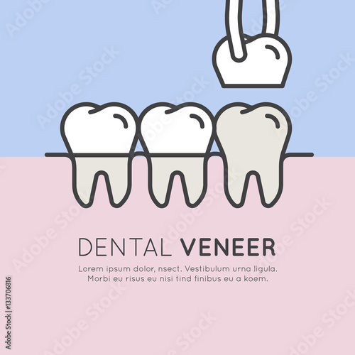 Isolated Vector Style Illustration Logo Badge or Dental Tooth Veneer Installation Process, Aesthetics, Orthodontist