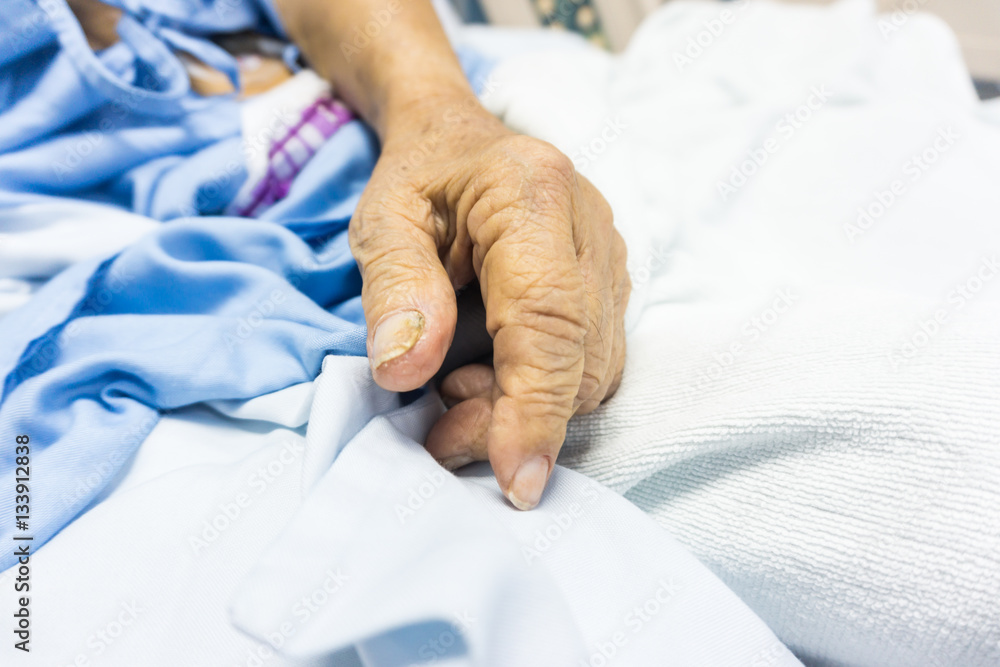 Senior sickness hand on bed of hospital