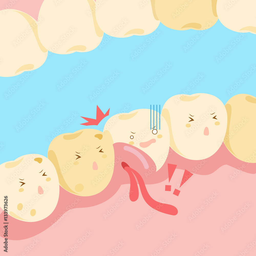 cartoon tooth with gingival swelling cartoon tooth with gingival swelling