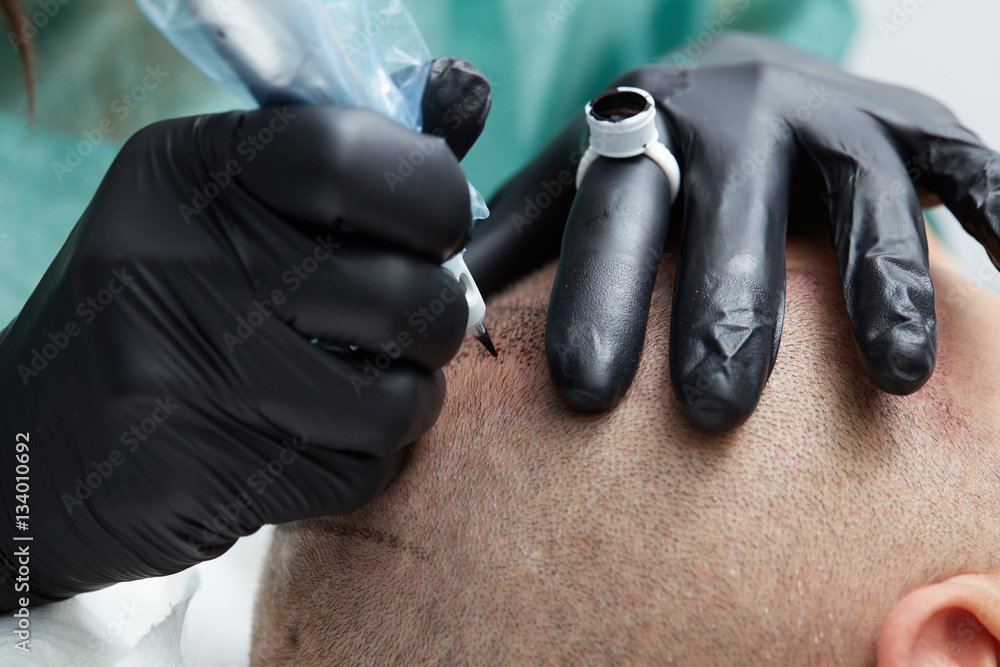 Fotografie Cosmetologist making permanent makeup on man head - tricopigmentation
